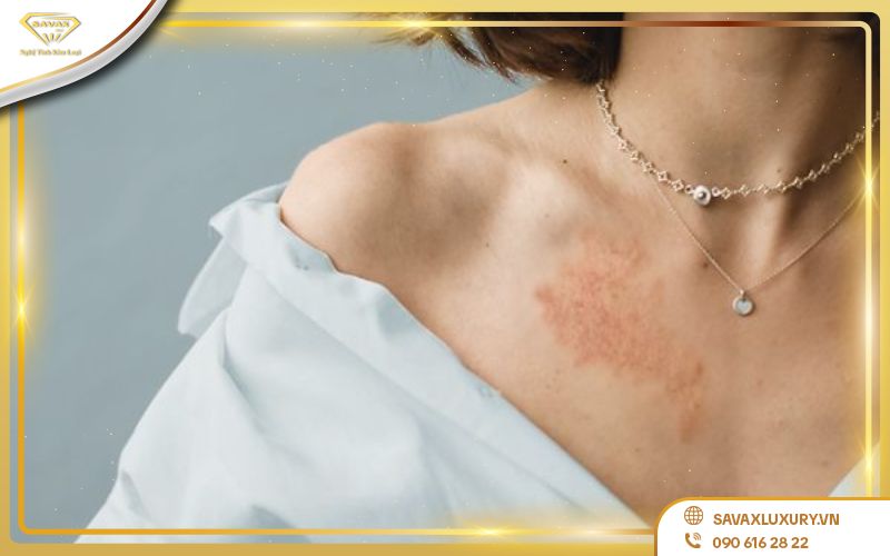 nhược điểm bạc 925